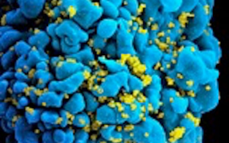 HIV virüsü, evrimin hızlandırılmış hali