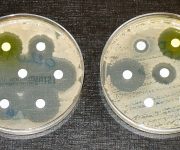 Antibiyotik direnci: Milyonlarca insan ölecek
