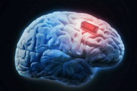 Suçlu: Beyin implantı