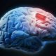 Suçlu: Beyin implantı