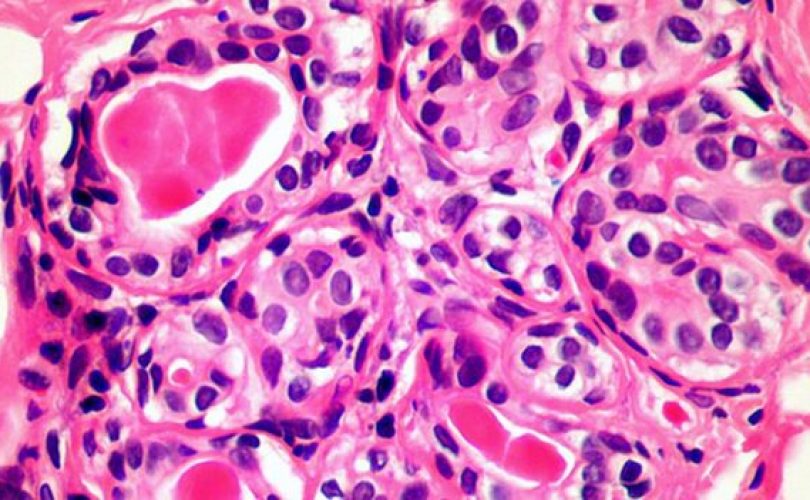 Bağışıklık sisteminin yeni keşfedilen özelliği ‘tüm kanserleri tedavi edebilir’