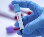 Çin’de bir üniversitede Kovid-19’u 15 dakikada tespit eden kit geliştirildi