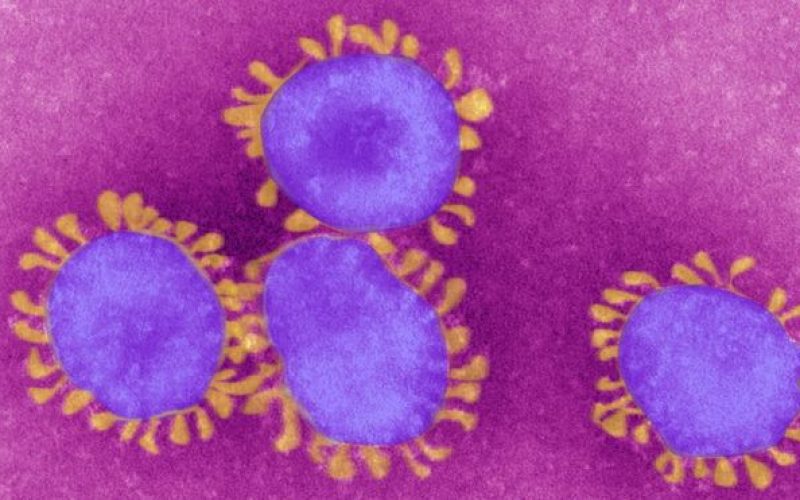 Dünya Sağlık Örgütü koronavirüsü pandemi ilan etti