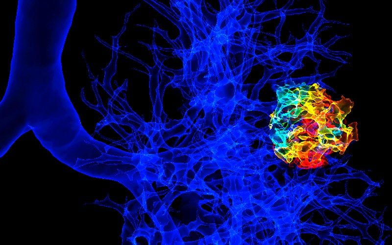 Akciğer kanserinin seyrini inceleyen uzun dönemli ilk çalışma