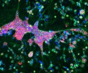 Uçuk virüsü Alzheimer hastalığını mı tetikliyor?