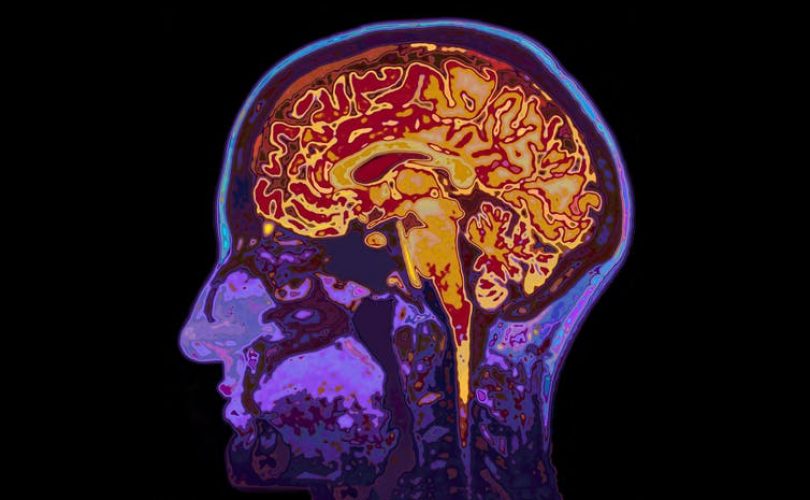 Migren beyni nasıl değiştiriyor?