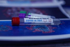 Yeni antikor tedavisi, şiddetli COVID-19’a karşı 18 aya kadar koruma sağlayabilir