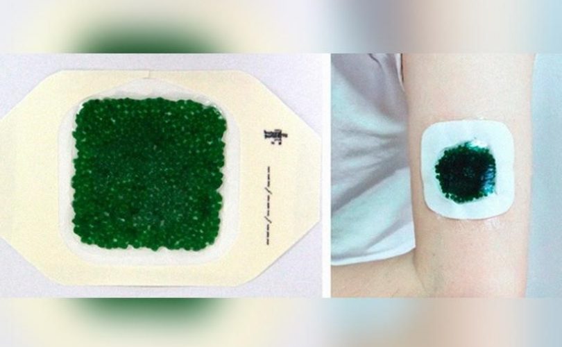 Bakteri içeren jel, yaraları daha çabuk iyileştiriyor