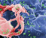 Bir insanın bağışıklık sistemi ilk kez HIV’i yendi