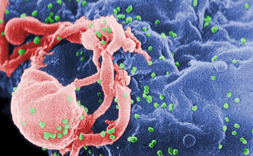 Bir insanın bağışıklık sistemi ilk kez HIV’i yendi