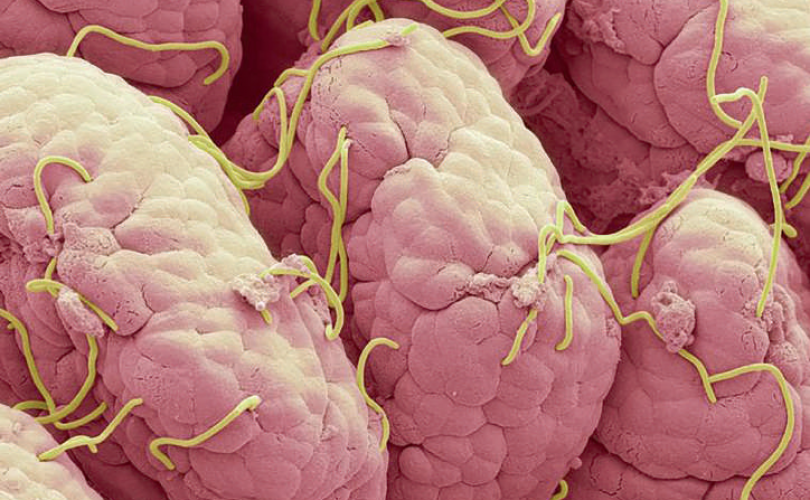 İçimizi kemiren kurt: Enterobiyazis