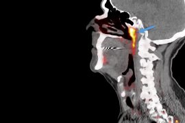 Keşfedilen yapılar yeni bir organ mı?