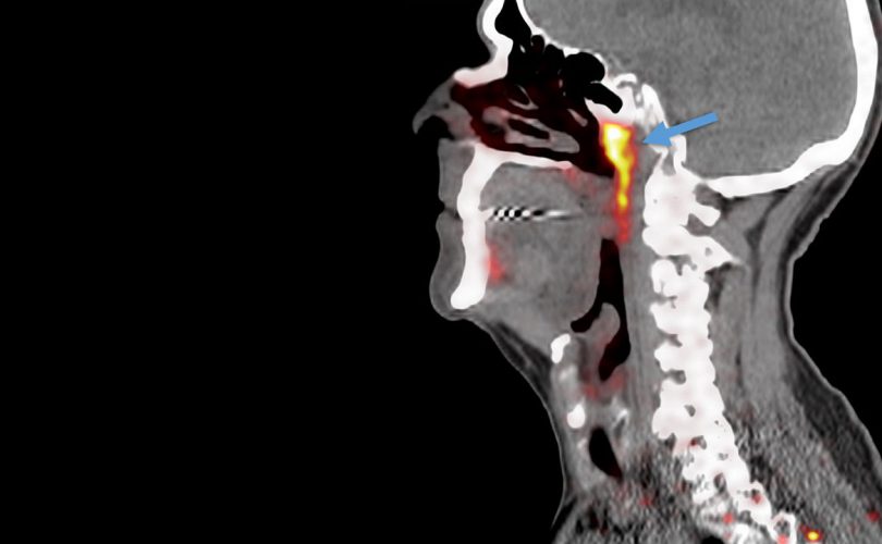 Keşfedilen yapılar yeni bir organ mı?