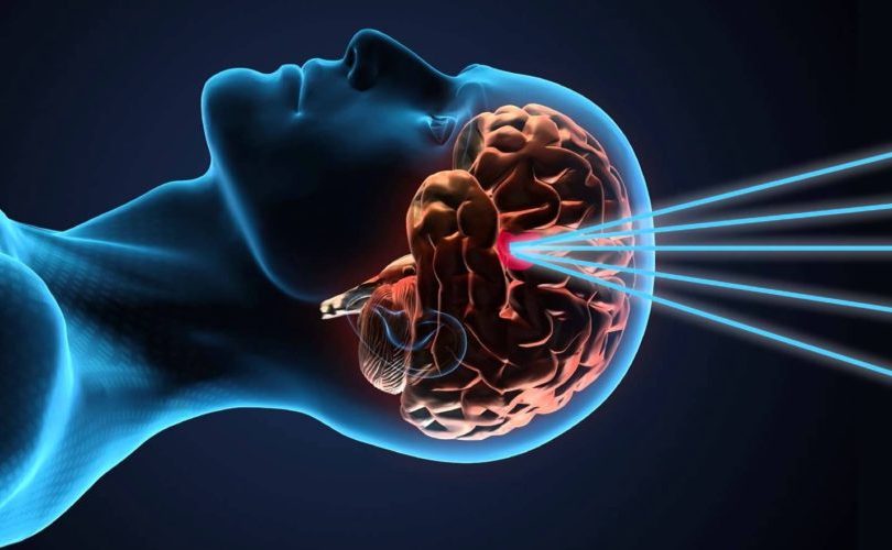 Beyne müdahalede yeni silah: Gamma Knife