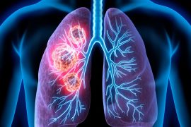 Akciğer kanserine yönelik yeni bir ilaç