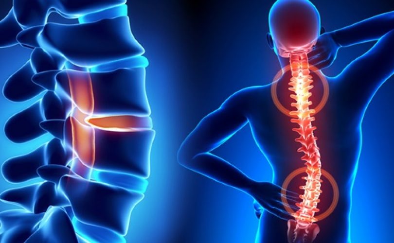 “Ülkemizde 1,5 milyon skolyoz hastası var”