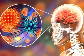 Bağışıklığın beyine saldırısı: Otoimmün ensefalit