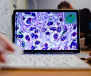 Yapay zekâ bağırsak kanserini de tanıyor