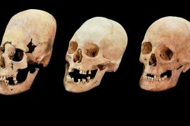 Ortaçağ dönemindeki uzun kadın kafataslarının gizemi