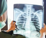 X-ışınlarının tıpta kullanılması