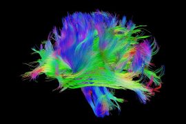 Beyin nasıl düşünce ve zihin oluşturur?