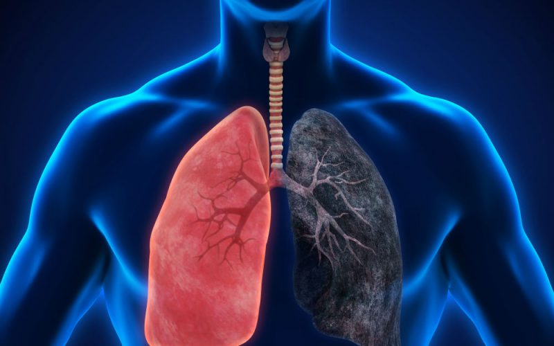 3 haftadan fazla süren öksürüğe dikkat!