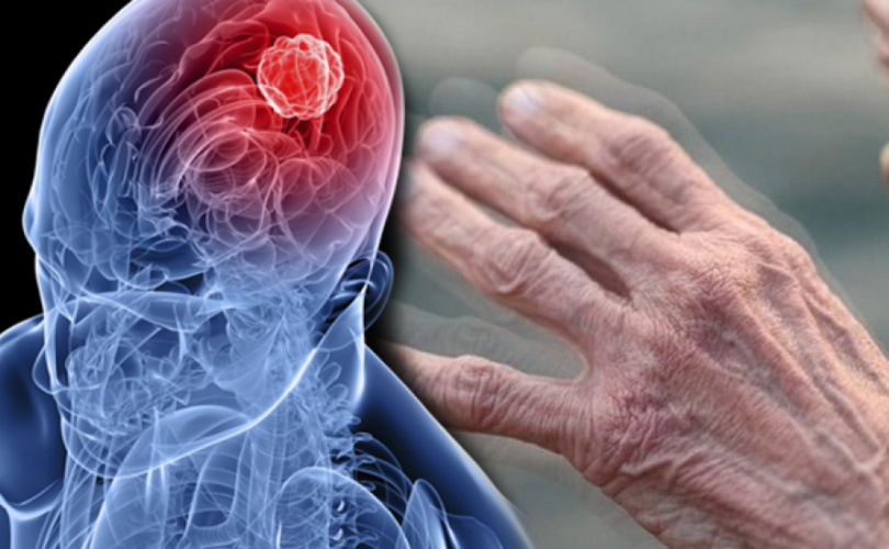 Parkinson hastalığı hakkında kısa bilgiler