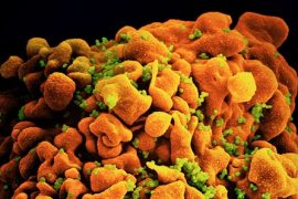 Mutasyona uğramış HIV varyantı tespit edildi