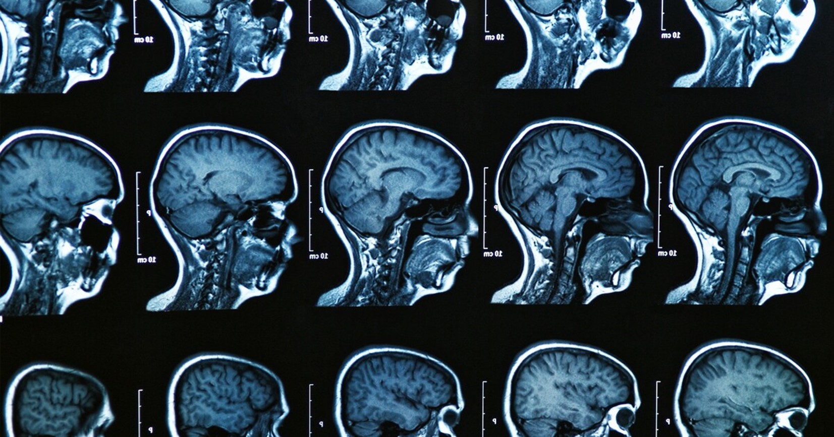 мрт информация. магнитное поле мрт. томография всего организма. влияние мрт на организм. влияние мрт на организм.