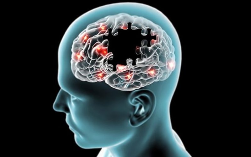 Tek beyin taraması ile Alzheimer teşhisi