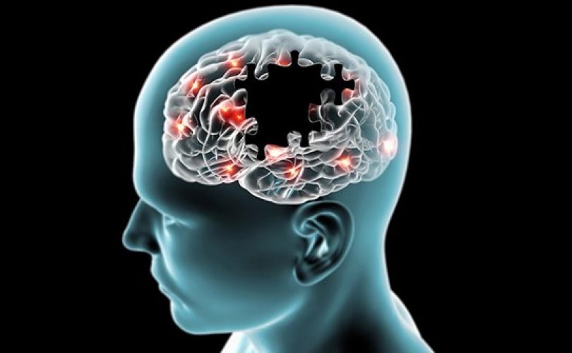 Tek beyin taraması ile Alzheimer teşhisi