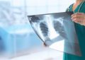 Yapay zeka tek röntgenle kalp krizini tahmin ediyor