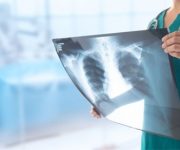 Yapay zeka tek röntgenle kalp krizini tahmin ediyor