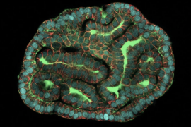 Amniyotik sıvıdan organoidler üretildi