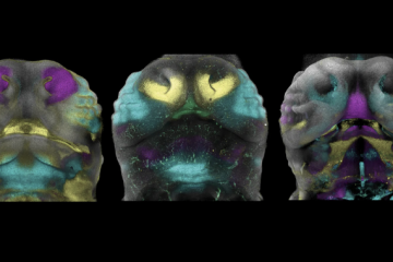 Hiçbir yüz birbirine benzemiyor, peki ama neden?