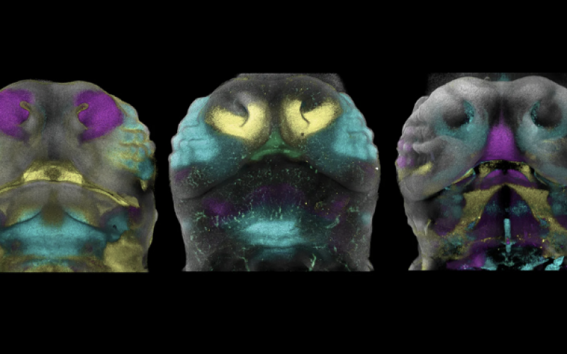 Hiçbir yüz birbirine benzemiyor, peki ama neden?