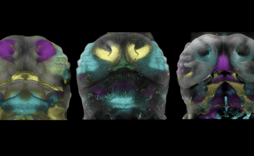 Hiçbir yüz birbirine benzemiyor, peki ama neden?